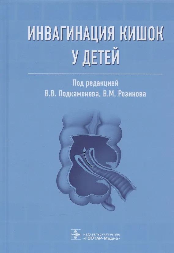 Книга Инвагинация кишок у детей (Владимир Подкаменев) — 1