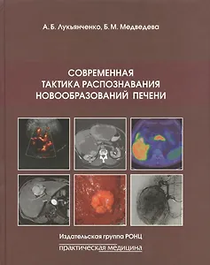 Современная тактика распознавания новообразований печени