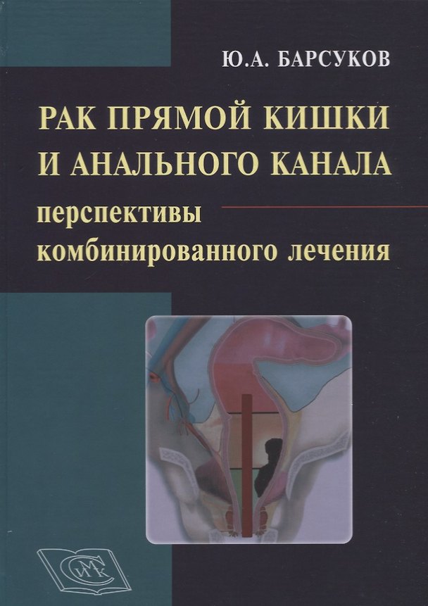 Книга Рак прямой кишки и анального канала: перспективы комбинированного лечения. Руководство для врачей (Ю. Барсуков) — 1
