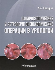 Лапароскопические и ретроперитонеоскопические операции в урологии.