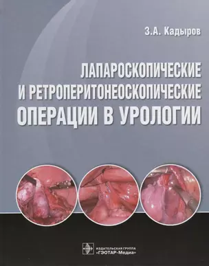 Лапароскопические и ретроперитонеоскопические операции в урологии. — 2636229 — 1