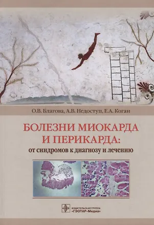 Книга Болезни миокарда и перикарда: от синдромов к диагнозу и лечению ()