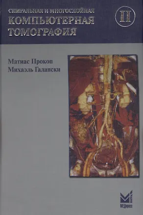 Книга Спиральная и многослойная компьютерная томография. Том 2. Учебное пособие (Матиас Прокоп)