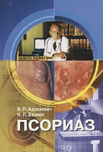 Псориаз