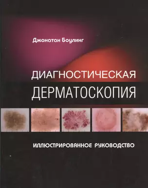 Диагностическая дерматоскопия Иллюстрированное руководство (м) Боулинг — 2525344 — 1