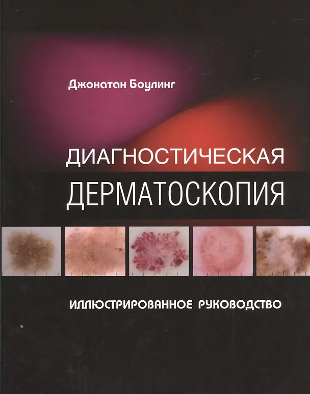 Книга Диагностическая дерматоскопия Иллюстрированное руководство (м) Боулинг () — 1