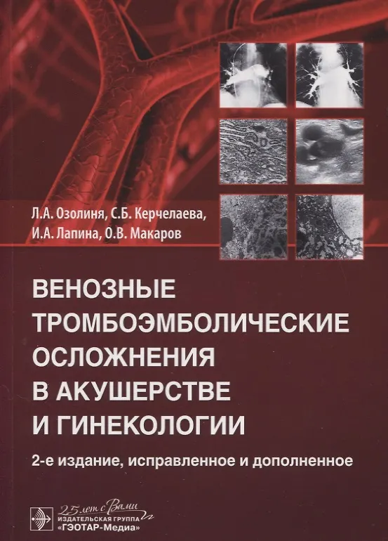 Книга Венозные тромбоэмболические осложнения в акушерстве и гинекологии (Ирина Лапина) — 1