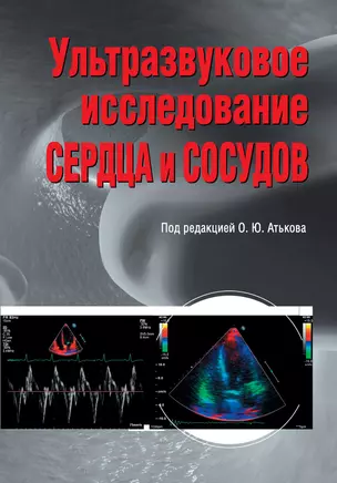 Ультразвуковое исследование сердца и сосудов — 2443218 — 1