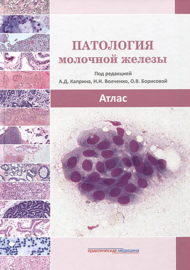Книга Патология молочной железы. Атлас (Надежда Волченко, Олеся Борисова) — 1