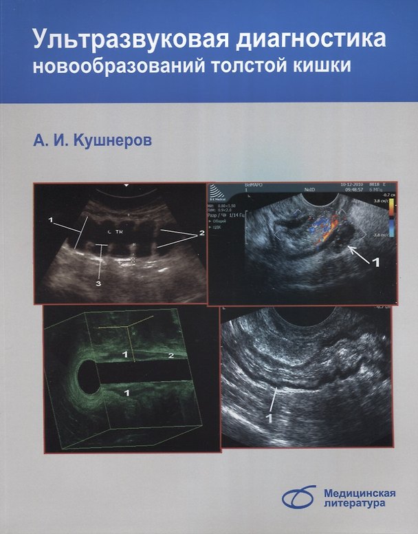 Книга Ультразвуковая диагностика новообразований толстой кишки (Александр Кушнеров) — 1