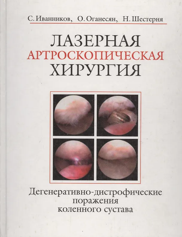 Книга Лазерная артроскопическая хирургия. Дегенеративно-дистрофические поражения коленного сустава (Сергей Иванников) — 1
