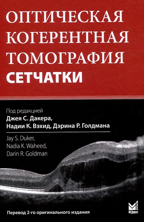 Книга Оптическая когерентная томография сетчатки. Перевод 2-го оригинального издания () — 1