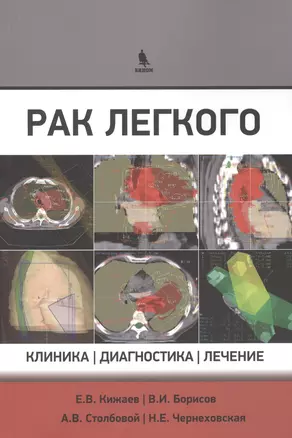 Рак легкого. Клиника, диагностика, лечение — 2458092 — 1