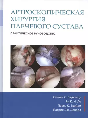 Артроскопическая хирургия плечевого сустава. Практическое руководство — 2525404 — 1