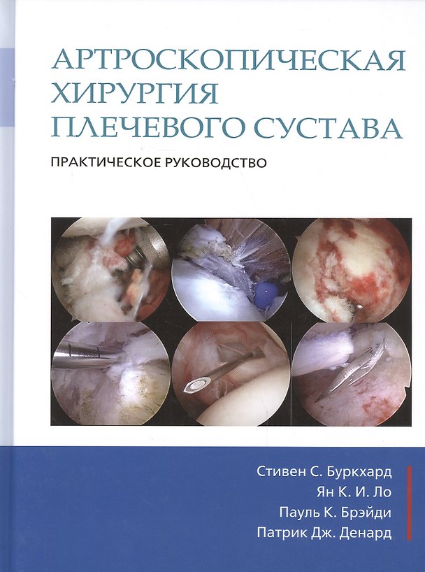 Книга Артроскопическая хирургия плечевого сустава. Практическое руководство (Стивен С. Буркхард) — 1