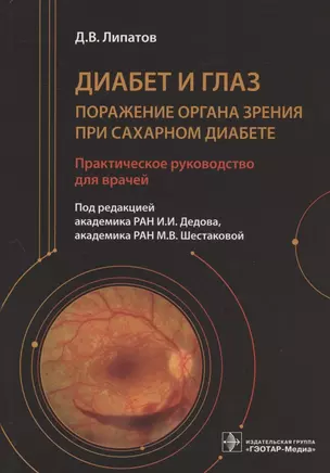 Диабет и глаз. Поражение органа зрения при сахарном диабете. Практическое руководство для врачей — 2880668 — 1