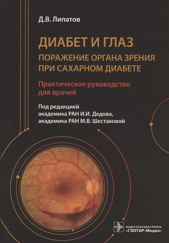 Книга Диабет и глаз. Поражение органа зрения при сахарном диабете. Практическое руководство для врачей (Дмитрий Липатов) — 1