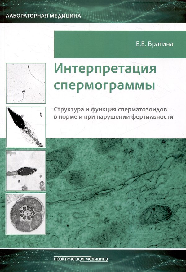 Книга Интерпретация спермограммы. Структура и функция сперматозоидов в норме и при нарушении фертильности (Елизавета Брагина) — 1