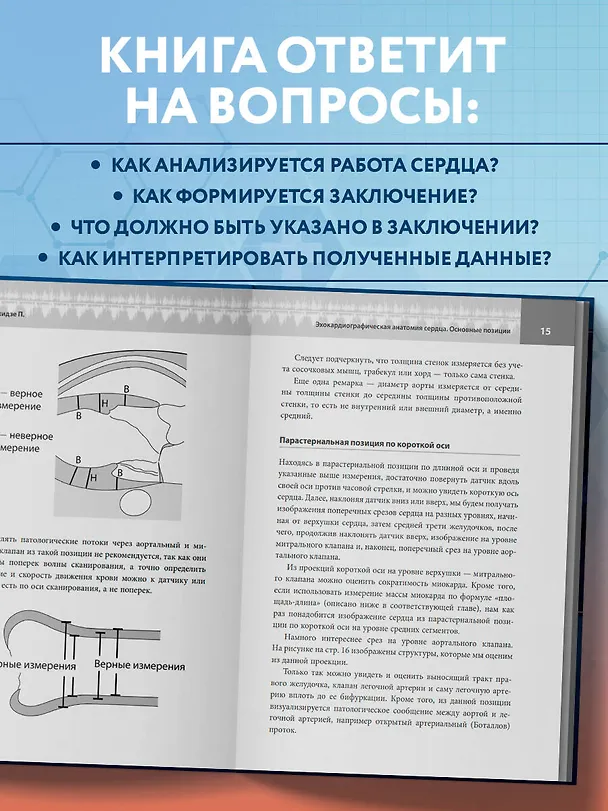 Книга Эхокардиография для начинающих. Суть гемодинамических нарушений, позиции для анализа, определение тяжести порока (Пётр Чомахидзе) — 7