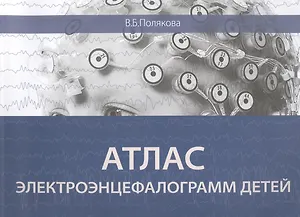Атлас электроэнцефалограмм детей