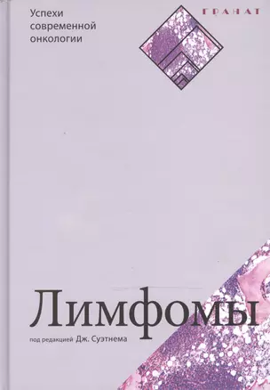 Лимфомы. Серия «Успехи современной онкологии» № 2. — 2471919 — 1