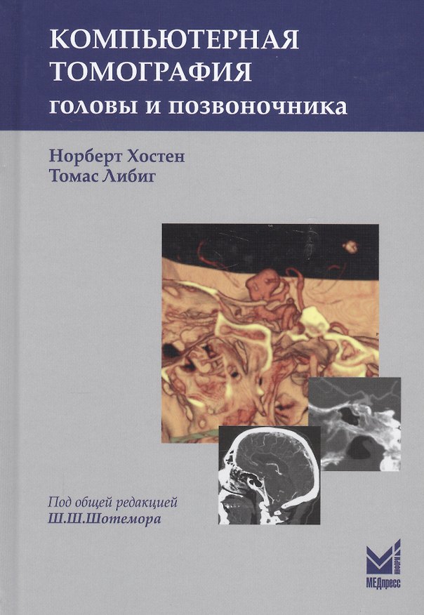 Книга Компьютерная томография головы и позвоночника (Норберт Хостен) — 1