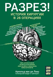 Разрез! История хирургии в 28 операциях