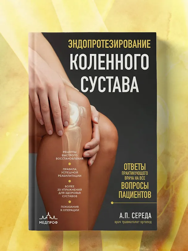 Книга Эндопротезирование коленного сустава: ответы практикующего врача на все вопросы пациентов (Андрей Середа) — 8