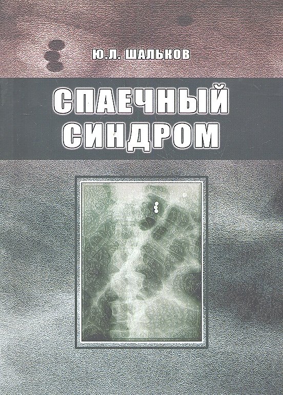 Книга Спаечный синдром. () — 1