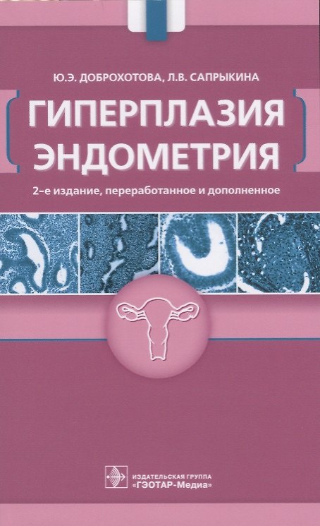 Книга Гиперплазия эндометрия (2 изд.) (м) Доброхотова (Юлия Доброхотова) — 1