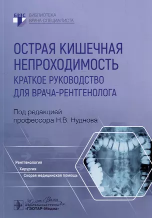 Острая кишечная непроходимость. Краткое руководство для врача-рентгенолога — 3018434 — 1