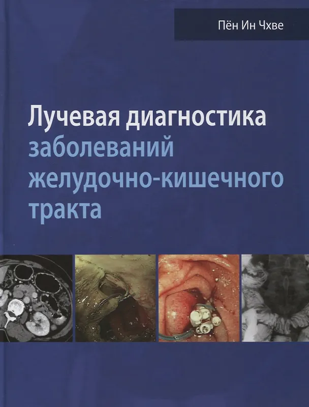Книга Лучевая диагностика заболеваний желудочно-кишечного тракта () — 1