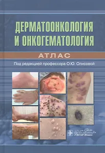 Дерматоонкология и онкогематология. Атлас