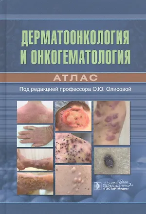 Книга Дерматоонкология и онкогематология. Атлас ()