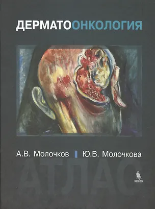 Книга Дерматоонкология. Атлас ()