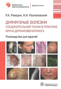 Диффузные болезни соединительной ткани в практике врача-дерматовенеролога. Руководство для врачей