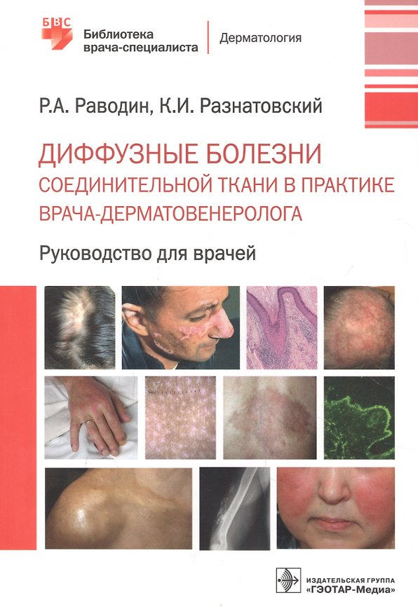 Книга Диффузные болезни соединительной ткани в практике врача-дерматовенеролога. Руководство для врачей (Роман Раводин) — 1