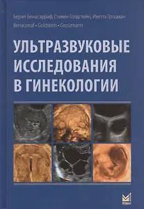 Ультразвуковые исследования в гинекологии