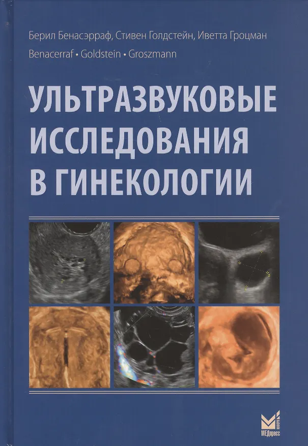 Книга Ультразвуковые исследования в гинекологии (Берил Бенасэрраф) — 1