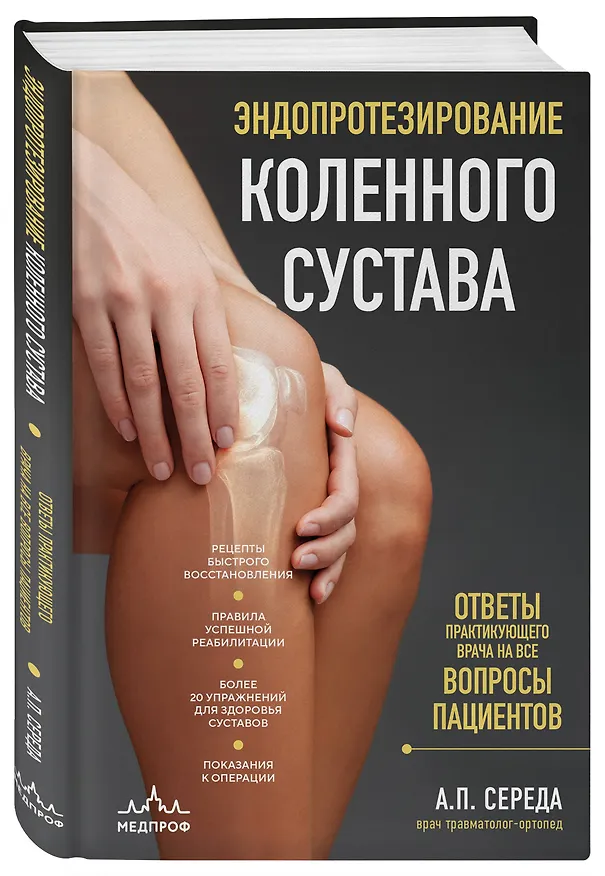 Книга Эндопротезирование коленного сустава: ответы практикующего врача на все вопросы пациентов (Андрей Середа) — 4