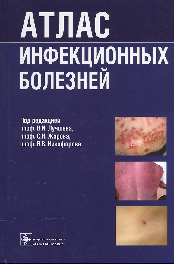 Книга Атлас инфекционных болезней (Владислав Лучшев) — 1