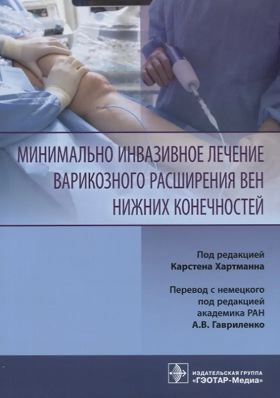 Книга Минимально инвазивное лечение варикозного расширения вен нижних конечностей () — 1