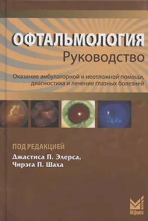 Книга Офтальмология. Руководство. Оказание амбулаторной и неотложной помощи, диагностики и лечение глазных болезней (Джастис Элерс)