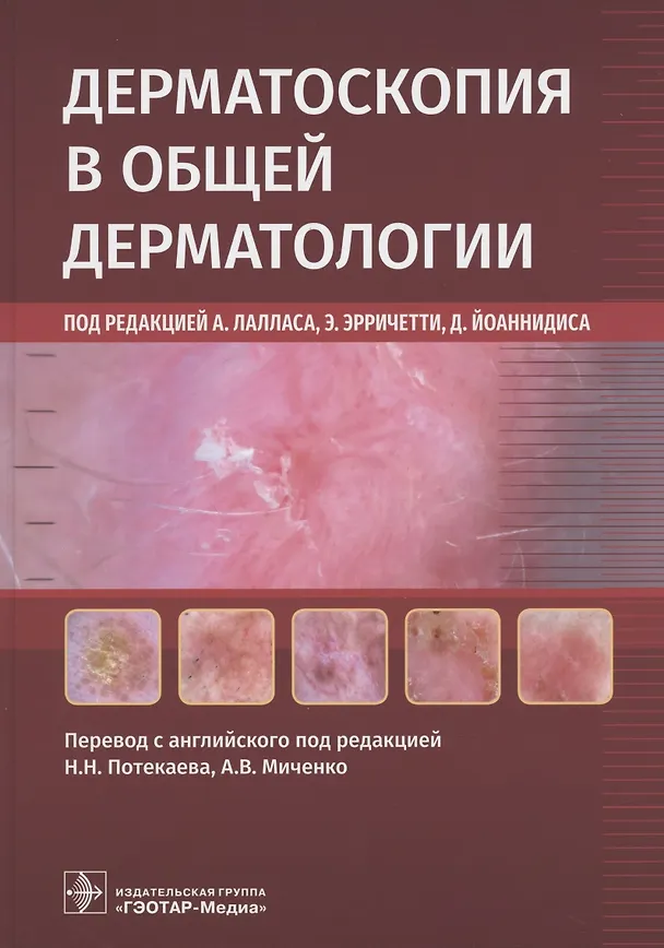 Книга Дерматоскопия в общей дерматологии () — 1