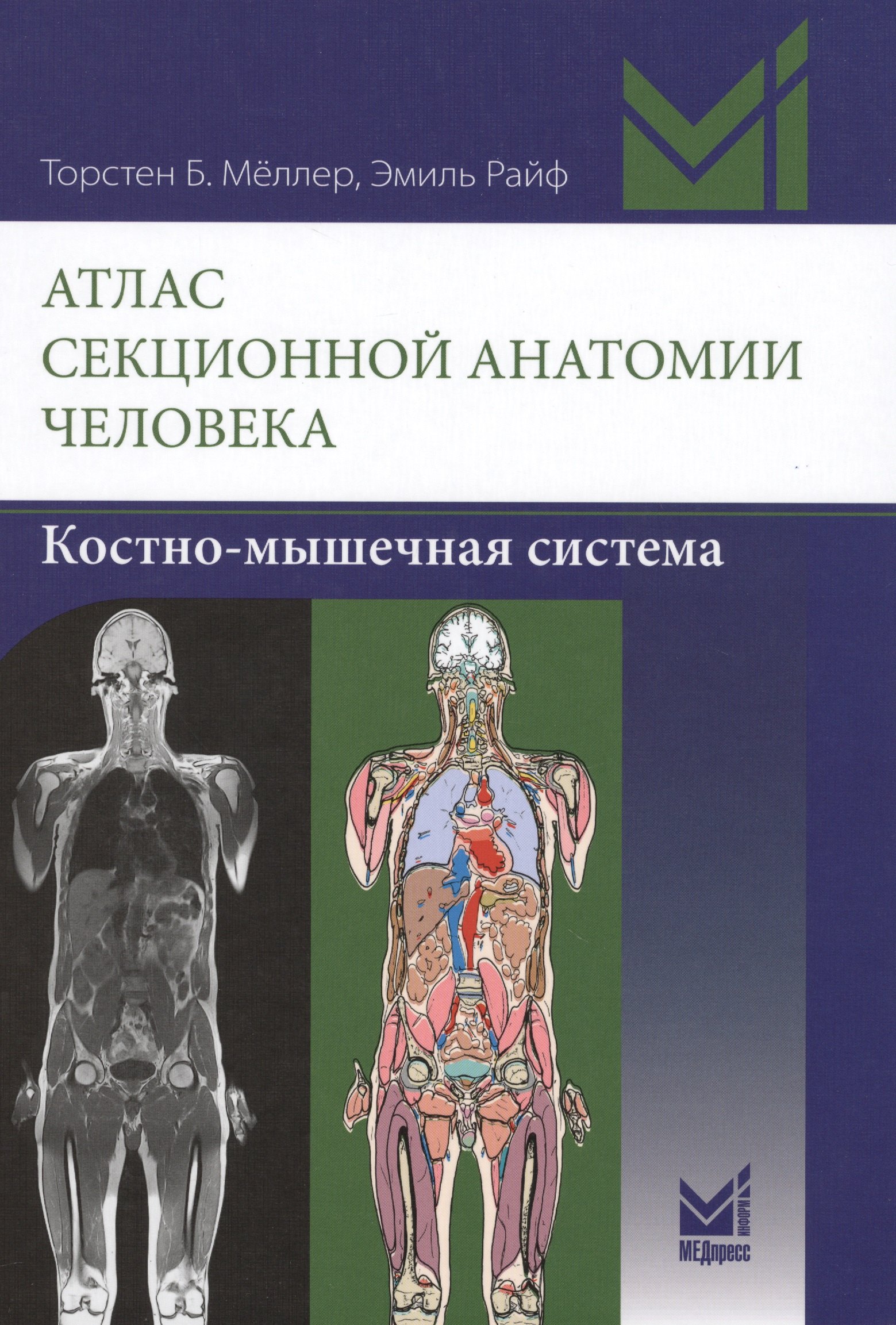 

Атлас секционной анатомии человека. Костно-мышечная система