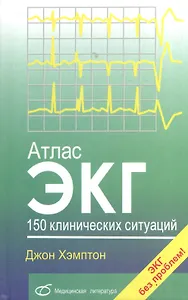 Атлас ЭКГ. 150 клинических ситуаций