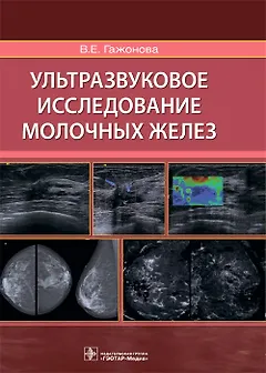 Ультразвуковое исследование молочных желез