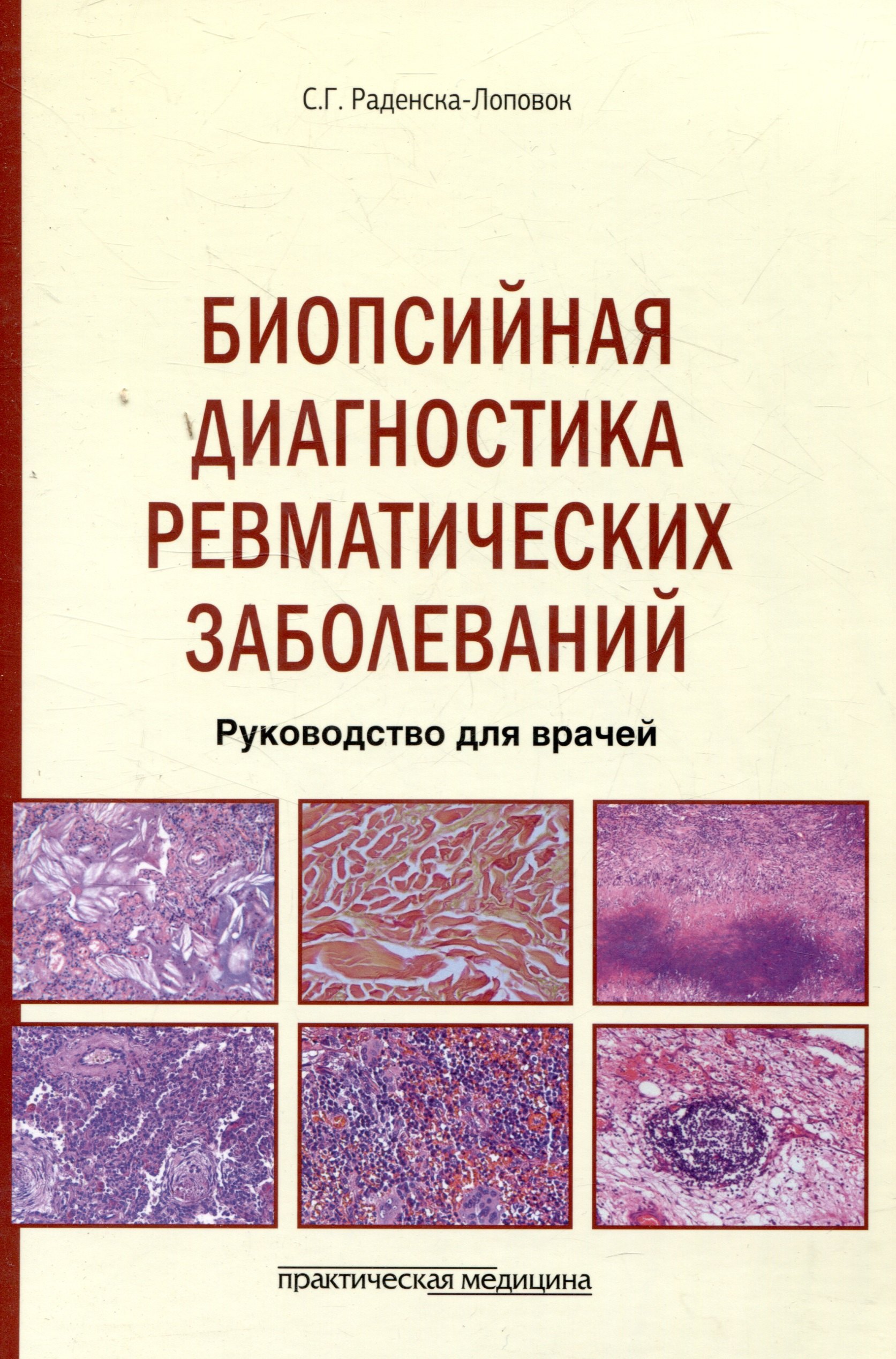 

Биопсийная диагностика ревматических заболеваний. Руководство для врачей