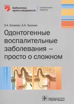 Одонтогенные воспалительные заболевания - просто о сложном — 2573796 — 1