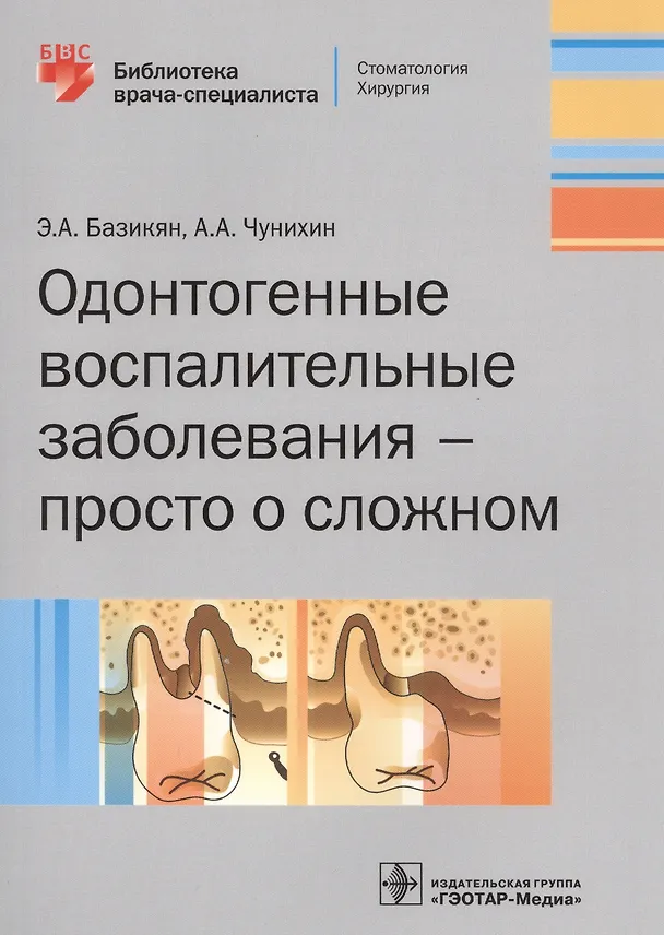 Книга Одонтогенные воспалительные заболевания - просто о сложном () — 1